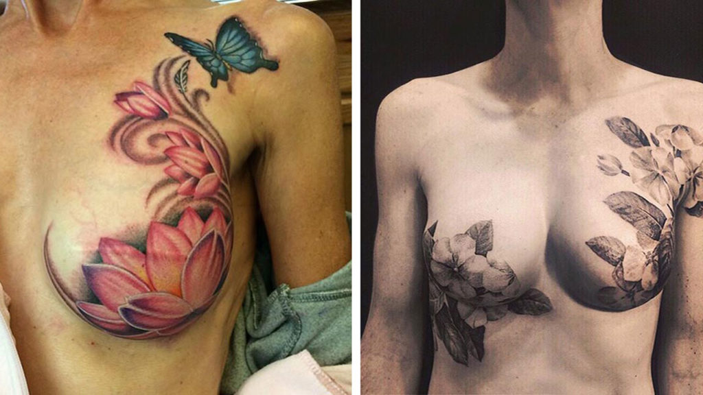Look How Beautifully Tattoo Artists Cover The Surgery Marks Of Breast Cancer  Survivors
