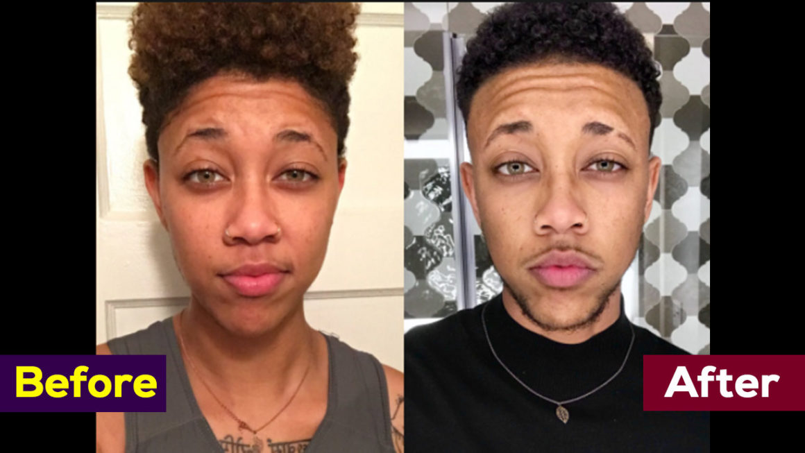 People Are Sharing Their Amazing Before-After Transgender Transformations P...