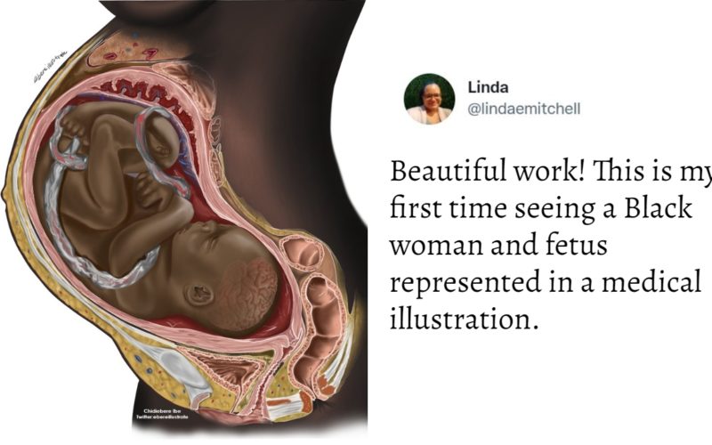 Man's Illustration Of A Black Foetus In Pregnant Woman Sparks Debate